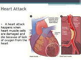 Diseases - Heart Disease
